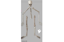 skeletset